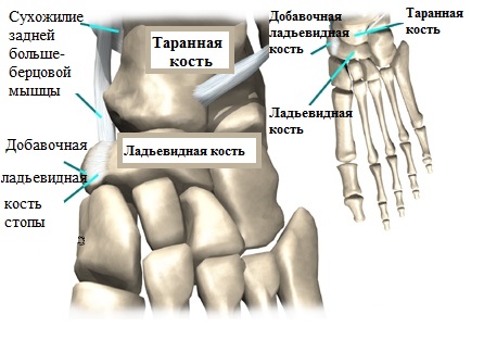 добавочная латьевидная кость стопы