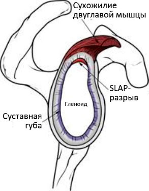 Поперечный срез плечевого сустава